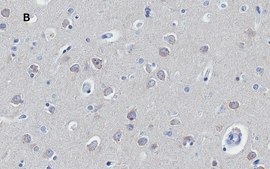 Anti-Huntingtin Protein Antibody, clone 1M11, ZooMAb® Rabbit Monoclonal recombinant, expressed in HEK 293 cells