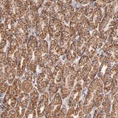 Anti-PHB antibody produced in rabbit Prestige Antibodies® Powered by Atlas Antibodies, affinity isolated antibody, buffered aqueous glycerol solution