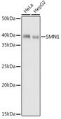 Anti-SMN1 Antibody, clone 9N9Q6, Rabbit Monoclonal