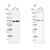 Anti-RPAP3 antibody produced in rabbit Prestige Antibodies® Powered by Atlas Antibodies, affinity isolated antibody, buffered aqueous glycerol solution