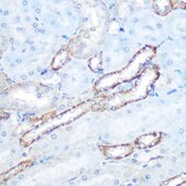 Anti-N-WASP/WASL antibody produced in rabbit
