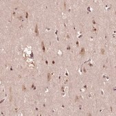 Anti-TMX2 antibody produced in rabbit Prestige Antibodies® Powered by Atlas Antibodies, affinity isolated antibody, buffered aqueous glycerol solution