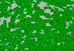 OSUMMER.4 Mouse NRAS-Mutant Melanoma Cell Line