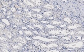 Anti-Integrin αV Antibody, clone 272-17E6 ZooMAb® Mouse Monoclonal recombinant, expressed in HEK 293 cells