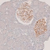 Anti-PLA2R1 antibody produced in rabbit Prestige Antibodies® Powered by Atlas Antibodies, affinity isolated antibody, buffered aqueous glycerol solution