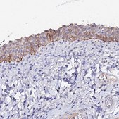 Anti-KRT17 antibody produced in rabbit Prestige Antibodies® Powered by Atlas Antibodies, affinity isolated antibody, buffered aqueous glycerol solution