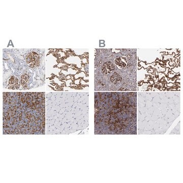 Anti-ICAM1 antibody produced in rabbit Prestige Antibodies® Powered by Atlas Antibodies, affinity isolated antibody, buffered aqueous glycerol solution