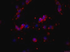 OSUMMER.3 Mouse NRAS-Mutant Melanoma Cell Line