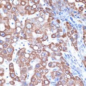 Anti-GOT2 antibody produced in rabbit