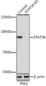 Anti- STAT5B antibody produced in rabbit