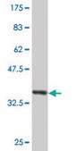 Monoclonal Anti-A2M antibody produced in mouse clone 2B5, purified immunoglobulin, buffered aqueous solution