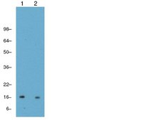 Anti-Trimethyl Histone H3 (Lys4) Antibody, clone CMA304 clone CMA304, from mouse