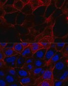 Anti-CD44 antibody produced in rabbit