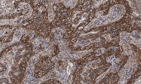 Anti-Integrin pan-αV Antibody, clone EM01309 , ZooMAb® Rabbit Monoclonal recombinant, expressed in HEK 293 cells