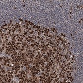 Anti-PCNA antibody produced in rabbit Prestige Antibodies® Powered by Atlas Antibodies, affinity isolated antibody, buffered aqueous glycerol solution, ab2