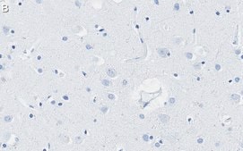 Anti-Presenilin-1 Antibody, clone 2O13 ZooMAb® Rabbit Monoclonal recombinant, expressed in HEK 293 cells