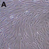 Human Mesenchymal Stem Cells (Bone Marrow) Human mesenchymal stem cells derived from bone marrow that have a capacity for expansion in vitro while maintaining their potential for differentiation to multiple lineages including adipocytes, osteoblasts and chondrocytes.