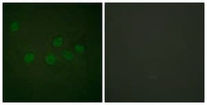Anti-CBP antibody produced in rabbit affinity isolated antibody