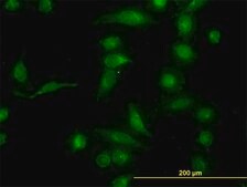 Monoclonal Anti-AKR1B10 antibody produced in mouse clone 1A6, purified immunoglobulin, buffered aqueous solution