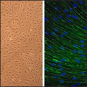 Rat Brain Microvascular Endothelial Cells: RBMVEC, adult