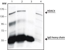 Anti-Histone Deacetylase 4 (HDAC4) (DM-15) antibody produced in rabbit affinity isolated antibody, buffered aqueous solution