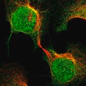 Anti-MED21 antibody produced in rabbit Prestige Antibodies® Powered by Atlas Antibodies, affinity isolated antibody, buffered aqueous glycerol solution