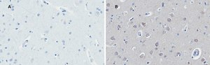 Anti-Huntingtin Protein Antibody, clone 1M11, ZooMAb® Rabbit Monoclonal recombinant, expressed in HEK 293 cells