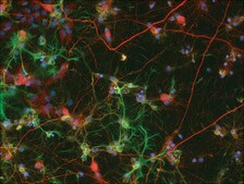 胶质纤维酸性蛋白（GFAP）单克隆抗体 小鼠抗 clone G-A-5, ascites fluid