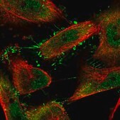 Anti-SRPK1 antibody produced in rabbit Prestige Antibodies® Powered by Atlas Antibodies, affinity isolated antibody