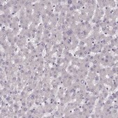 Anti-PRSS37 antibody produced in rabbit Prestige Antibodies® Powered by Atlas Antibodies, affinity isolated antibody, buffered aqueous glycerol solution