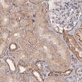 抗-ERBB2 兔抗 Ab1, Prestige Antibodies® Powered by Atlas Antibodies, affinity isolated antibody, buffered aqueous glycerol solution