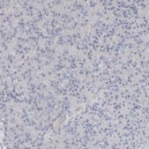 Anti-ARG1 antibody produced in rabbit Prestige Antibodies® Powered by Atlas Antibodies, affinity isolated antibody, buffered aqueous glycerol solution