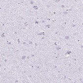 Anti-PRM2 antibody produced in rabbit Prestige Antibodies® Powered by Atlas Antibodies, affinity isolated antibody, buffered aqueous glycerol solution