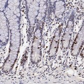 抗-MKI67 兔抗 Ab1, Prestige Antibodies® Powered by Atlas Antibodies, affinity isolated antibody, buffered aqueous glycerol solution