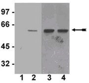 Anti-phospho-Akt1/PKBα (Ser473) Antibody, clone SK703, rabbit monoclonal culture supernatant, clone SK703, Upstate®