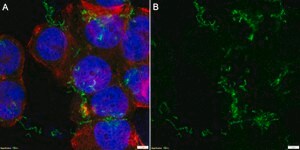 Anti-ROR2 clone XBR2-401 ZooMAb® Rabbit Monoclonal recombinant, expressed in HEK 293 cells