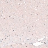 Monoclonal Anti-POU3F2 antibody produced in mouse Prestige Antibodies® Powered by Atlas Antibodies, clone CL6228, purified immunoglobulin, buffered aqueous glycerol solution