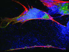 黏着斑蛋白单克隆抗体 小鼠抗 clone hVIN-1, ascites fluid