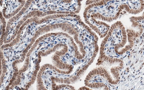 Anti-PCIF1 Antibody, clone 1E21 ZooMAb&#174; Rabbit Monoclonal recombinant, expressed in HEK 293 cells