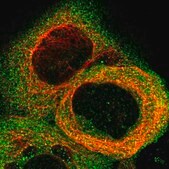 Anti-STAT2 antibody produced in rabbit Prestige Antibodies® Powered by Atlas Antibodies, affinity isolated antibody, buffered aqueous glycerol solution