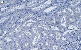 Anti-SMN Antibody, clone 2B1 ZooMAb® Mouse Monoclonal recombinant, expressed in HEK 293 cells