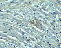 Anti-RIG-1 antibody produced in rabbit purified antibody (DEAE)