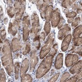 Anti-UFL1 antibody produced in rabbit Prestige Antibodies® Powered by Atlas Antibodies, affinity isolated antibody, buffered aqueous glycerol solution, ab3