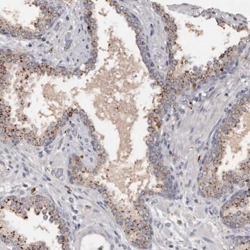 Anti-DAP antibody produced in rabbit Prestige Antibodies® Powered by Atlas Antibodies, affinity isolated antibody, buffered aqueous glycerol solution