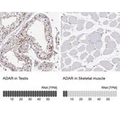 Anti-ADAR antibody produced in rabbit Prestige Antibodies® Powered by Atlas Antibodies, affinity isolated antibody, buffered aqueous glycerol solution
