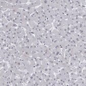 Anti-CETN1 antibody produced in rabbit Prestige Antibodies® Powered by Atlas Antibodies, affinity isolated antibody, buffered aqueous glycerol solution