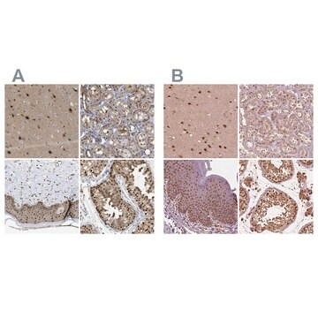 Anti-PSMC5 antibody produced in rabbit Prestige Antibodies® Powered by Atlas Antibodies, affinity isolated antibody, buffered aqueous glycerol solution