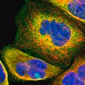 Anti-USP2 antibody produced in rabbit Ab1, Prestige Antibodies® Powered by Atlas Antibodies, affinity isolated antibody, buffered aqueous glycerol solution