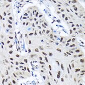 Anti-SMN1 Antibody, clone 9N9Q6, Rabbit Monoclonal