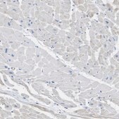 Anti-MYH11 antibody produced in rabbit Prestige Antibodies® Powered by Atlas Antibodies, affinity isolated antibody, buffered aqueous glycerol solution